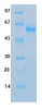 SARS-CoV-2 (COVID-19) NSP16 Recombinant Protein | 20-243