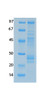 SARS-CoV-2 (COVID-19) NSP2 Recombinant Protein | 20-254