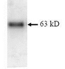 SDS Page pattern of purified IMP-1 recombinant protein was stained with Coomassie Blue.