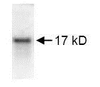 SDS Page pattern of purified TNF-alpha recombinant protein was stained with Coomassie Blue.