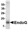 SDS-PAGE analysis of recombinant EndoG fragment on Coomassie Blue-stained 4-20% gradient gel.