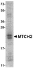 SDS-PAGE analysis of recombinant MTCH2 on Coomassie Blue-stained 12% SDS-PAGE gel.