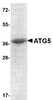 SDS-PAGE analysis of recombinant ATG5 on Coomassie Blue-stained 4 - 12% SDS-PAGE gel.