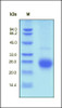 Human ALK-1, His Tag on SDS-PAGE under reducing (R) condition. The gel was stained overnight with Coomassie Blue. The purity of the protein is greater than 97%.