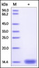 Cynomolgus / Rhesus macaque B2M, His Tag on SDS-PAGE under reducing (R) condition. The gel was stained overnight with Coomassie Blue. The purity of the protein is greater than 95%.