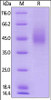 Human B7-1, His Tag on SDS-PAGE under reducing (R) condition. The gel was stained overnight with Coomassie Blue. The purity of the protein is greater than 90%.