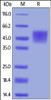 Human B7-H4, His Tag on SDS-PAGE under reducing (R) condition. The gel was stained overnight with Coomassie Blue. The purity of the protein is greater than 95%.