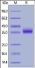 Human IL-2 R beta, His Tag (SPR verified) on SDS-PAGE under reducing (R) condition. The gel was stained overnight with Coomassie Blue. The purity of the protein is greater than 95%.