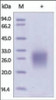 The purity of rh CD74 was determined by DTT-reduced (+) SDS-PAGE and staining overnight with Coomassie Blue.