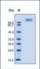 The purity of rh CD62E was determined by DTT-reduced (+) SDS-PAGE and staining overnight with Coomassie Blue.