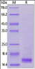 Human CD3 epsilon, His Tag on SDS-PAGE under reducing (R) condition. The gel was stained overnight with Coomassie Blue. The purity of the protein is greater than 90%.