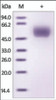 The purity of rh CLUS / Clusterin was determined by DTT-reduced (+) SDS-PAGE and staining overnight with Coomassie Blue.