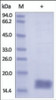 The purity of rh CST2 / Cystatin-SA was determined by DTT-reduced (+) SDS-PAGE and staining overnight with Coomassie Blue.