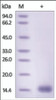 The purity of rh CST5 /Cystatin-D was determined by DTT-reduced (+) SDS-PAGE and staining overnight with Coomassie Blue.