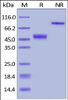 Human CTLA-4, Fc Tag on SDS-PAGE under reducing (R) and non-reducing (NR) conditions. The gel was stained overnight with Coomassie Blue. The purity of the protein is greater than 98%.