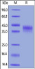 Human Dkk-1, His Tag on SDS-PAGE under reducing (R) condition. The gel was stained overnight with Coomassie Blue. The purity of the protein is greater than 95%.