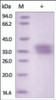 The purity of rh Ephrin-B1 /EFNB1 was determined by DTT-reduced (+) SDS-PAGE and staining overnight with Coomassie Blue.