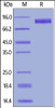 Mouse EGF R, His Tag on SDS-PAGE under reducing (R) condition. The gel was stained overnight with Coomassie Blue. The purity of the protein is greater than 95%.