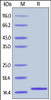 Human FABP2, His Tag on SDS-PAGE under reducing (R) condition. The gel was stained overnight with Coomassie Blue. The purity of the protein is greater than 98%.