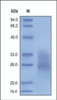 The purity of rh Fas was determined by DTT-reduced (+) SDS-PAGE and staining overnight with Coomassie Blue.
