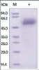 The purity of rh FetuinA / FETUA / AHSG was determined by DTT-reduced (+) SDS-PAGE and staining overnight with Coomassie Blue.