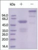 The purity of rh FGF9 Fc Chimera was determined by DTT-reduced (+) and non-reduced (-) SDS-PAGE and staining overnight with Coomassie Blue.