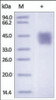 The purity of rh FSTL1 / FRP was determined by DTT-reduced (+) SDS-PAGE and staining overnight with Coomassie Blue.