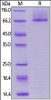 Human Glypican 3 (S359F) , His Tag, low endotoxin on SDS-PAGE under reducing (R) condition. The gel was stained overnight with Coomassie Blue. The purity of the protein is greater than 90%.