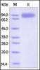 HIV-1 [HIV-1/Clade E (CM244) ] GP120, His Tag on SDS-PAGE under reducing (R) condition. The gel was stained overnight with Coomassie Blue. The purity of the protein is greater than 95%.