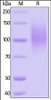 HIV-1 [HIV-1/Clade B/C (CN54) ] GP120, His Tag on SDS-PAGE under reducing (R) condition. The gel was stained overnight with Coomassie Blue. The purity of the protein is greater than 95%.