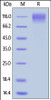 HIV-1 [HIV-1/Clade C (16055) ] GP120, His Tag on SDS-PAGE under reducing (R) condition. The gel was stained overnight with Coomassie Blue. The purity of the protein is greater than 95%.