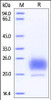 Human HE4, His Tag on SDS-PAGE under reducing (R) condition. The gel was stained overnight with Coomassie Blue. The purity of the protein is greater than 95%.