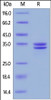 Human HMGB1, His Tag on SDS-PAGE under reducing (R) condition. The gel was stained overnight with Coomassie Blue. The purity of the protein is greater than 95%.