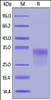 Human SOST, His Tag on SDS-PAGE under reducing (R) condition. The gel was stained overnight with Coomassie Blue. The purity of the protein is greater than 95%.