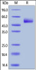 Human HVEM, Fc Tag on SDS-PAGE under reducing (R) condition. The gel was stained overnight with Coomassie Blue. The purity of the protein is greater than 95%.