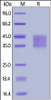 Human IFNAR2, His Tag on SDS-PAGE under reducing (R) condition. The gel was stained overnight with Coomassie Blue. The purity of the protein is greater than 95%.