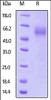 Human IL-1RL1, His Tag on SDS-PAGE under reducing (R) condition. The gel was stained overnight with Coomassie Blue. The purity of the protein is greater than 90%.