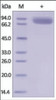 The purity of rh IL1R2 /CD121b Fc Chimera was determined by DTT-reduced (+) SDS-PAGE and staining overnight with Coomassie Blue.