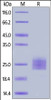 Human IL-17E, His Tag on SDS-PAGE under reducing (R) condition. The gel was stained overnight with Coomassie Blue. The purity of the protein is greater than 95%.