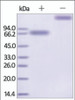The purity of rh IL21R / CD360 Fc Chimera was determined by DTT-reduced (+) and non-reduced (-) SDS-PAGE and staining overnight with Coomassie Blue.