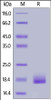 Human LAIR-2, His Tag on SDS-PAGE under reducing (R) condition. The gel was stained overnight with Coomassie Blue. The purity of the protein is greater than 95%.