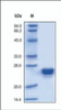 The purity of rh LCN2 was determined by DTT-reduced (+) SDS-PAGE and staining overnight with Coomassie Blue.