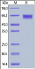 Human LILRB2, His Tag on SDS-PAGE under reducing (R) condition. The gel was stained overnight with Coomassie Blue. The purity of the protein is greater than 92%.