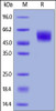 Human MICA, His Tag on SDS-PAGE under reducing (R) condition. The gel was stained overnight with Coomassie Blue. The purity of the protein is greater than 95%.