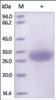 The purity of rh MSLN / Mesothelin /MPF was determined by DTT-reduced (+) SDS-PAGE and staining overnight with Coomassie Blue.