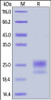 Human NPC2, His Tag on SDS-PAGE under reducing (R) condition. The gel was stained overnight with Coomassie Blue. The purity of the protein is greater than 95%.