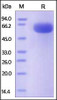 Human CD200, Fc Tag on SDS-PAGE under reducing (R) condition. The gel was stained overnight with Coomassie Blue. The purity of the protein is greater than 95%.