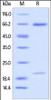 Human PCSK9, His Tag on SDS-PAGE under reducing (R) condition. The gel was stained overnight with Coomassie Blue. The purity of the protein is greater than 97%.