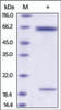 The purity of Rat PCSK9 was determined by DTT-reduced (+) SDS-PAGE and staining overnight with Coomassie Blue.