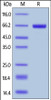 Human PH20, His Tag on SDS-PAGE under reducing (R) condition. The gel was stained overnight with Coomassie Blue. The purity of the protein is greater than 92%.